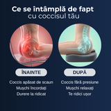 Pernă cu Gel pentru Scaun – Delfino® — imaginea 7